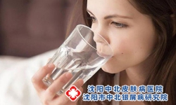 牛皮癣疾病如何治疗好 牛皮癣疾病怎么护理好呢