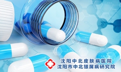 治疗沈阳牛皮癣的好的药物