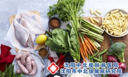 牛皮癣吃什么 牛皮癣的饮食禁忌有哪些呢