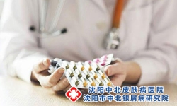 如何在生活中预防银屑病?
