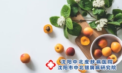 银屑病患者如何缓解大量脱屑?