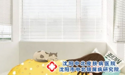 沈阳治疗牛皮癣医院专科：牛皮癣患者的作息应注意什么?