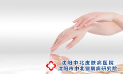 银屑病关节炎手指消肿的方法