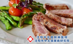 寻常型牛皮癣的饮食保健有哪些?