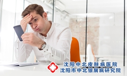 中年银屑病患者压力大怎么办