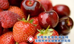 牛皮癣患者忌食有哪些注意事项
