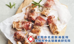 银屑病好了可以吃猪肉吗？