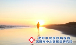 紫外线照射对牛皮癣的具体影响