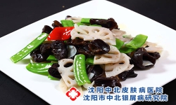 影响沈阳牛皮癣患者病情的反复因素