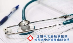 发病初期银屑病如何治疗？