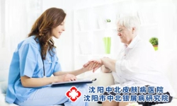 沈阳老年人得了牛皮癣的护理措施