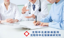 银屑病治疗方案，如何选择适合的?沈阳银屑病医院，沈阳牛皮癣医院，沈阳皮肤病医院
