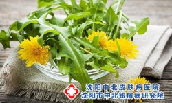 沈阳中北银屑病医院：叶酸与银屑病患者的关系
