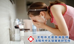 银屑病皮损位置不同，护理方法也有所差别!