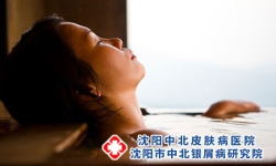 沈阳看牛皮癣医院教你：牛皮癣患者如何正确汗蒸