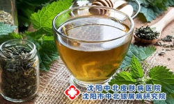 有牛皮癣可以喝大麦茶吗?