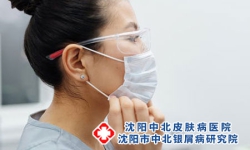 初期寻常银屑病容易冶好吗?