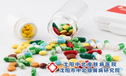 沈阳治牛皮癣的药是什么药