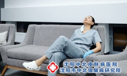 银屑病的四大致病因素，你中了几个?