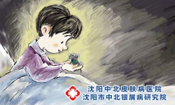 患者得牛皮癣心情不好怎么办