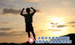 牛皮癣患者保健工作怎么做
