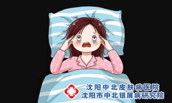 牛皮癣的诱发因素包括哪些-牛皮癣的3个诱发因素揭晓