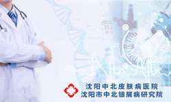 沈阳银屑病的病因的相关介绍