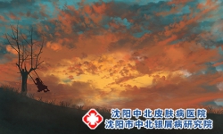 远离这些环境，让银屑病更快康复!沈阳银屑病医院