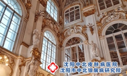 怎么治疗牛皮癣效果好