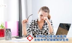 哪些情况会导致牛皮癣病情加重?