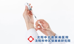沈阳中北银屑病医院治疗银屑病大概得多少钱