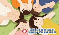 有哪些症状可以提示孩子可能患有银屑病?