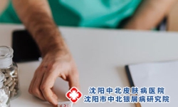 沈阳牛皮癣哪家医院好：牛皮癣的四大类型到底是什么
