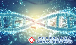 哪些原因会导致牛皮癣扩散？