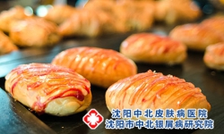 银屑病患者可以吃面包吗？