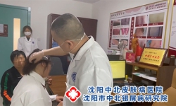 沈阳牛皮癣病专科医院排名，好的牛皮癣医院选择标准?