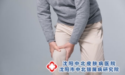 牛皮癣性关节炎该怎么治疗呢?