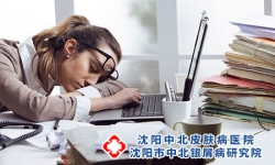 沈阳银屑病患者工作要注意什么