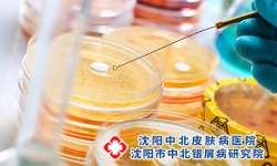 青霉素可以治银屑病吗?
