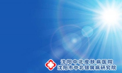 银屑病夏轻冬重是为什么？