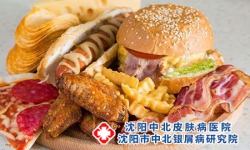 韭菜能治好牛皮癣吗 牛皮癣的饮食禁忌有哪些