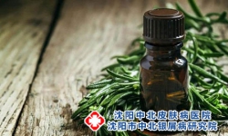 国医名家：银屑病预防的六大法宝!沈阳银屑病医院