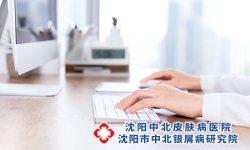 白领患上牛皮癣和平时使用电脑有何联系