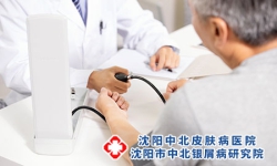 银屑病不可怕，重在科学规范治疗!