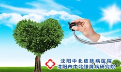 牛皮癣几大心理疗法是哪些