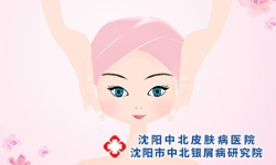 怎么做可预防沈阳银屑病复发