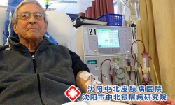 银屑病并发症有哪些?