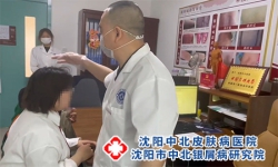 沈阳治疗牛皮癣的专科医院