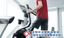 巩固抗复发的重要性，银屑病患者们一定要知道!
