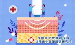 牛皮癣热敷还是冷敷好？